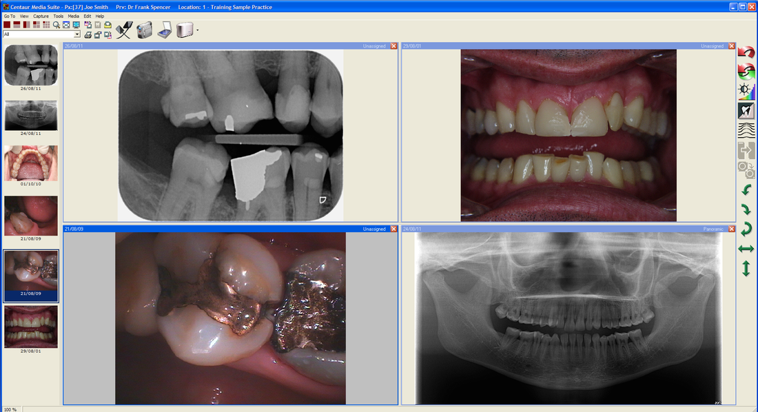 D4W Dental Practice Management Software